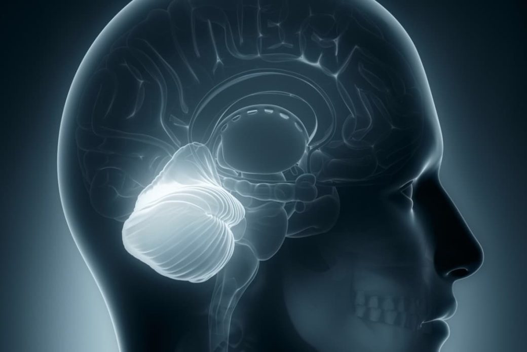 小脳の疾患「失調」とは？麻痺との違いを理解して有効なリハビリを。